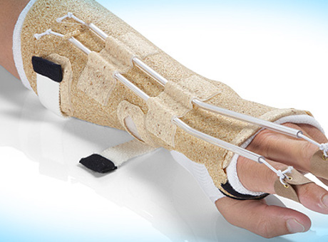 Treating fractures with a biodegradable material: Primo manufactures revolutionary new materials for orthopaedic casts